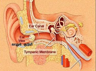 நீரிழிவு நோயாளருக்கு காதுகளில் காதுக்குடுமி அதிகம் சேர்வதாலும் காது கேட்பதில் சிறிய பாதிப்பு ஏற்படும். இது கொக்கிளியா பாதிப்புறுவதுபோல கடுமையான பாதிப்பு அல்ல. ஒலியானது செவிப்பறையை அடைவதைக் காதுக்குடுமி தடுப்பதாலேயே ஏற்படுகிறது. காதுக்குடுமி காதுகளை அடைப்பது எவரிலும் நேரலாம் என்ற போதும் நீரிழிவாளர்களில் ஏற்படுவதற்கான சாத்தியம் அதிகமாகும். இதற்குக் காரணம் அவர்களது சருமத்தில் உள்ள கெரடின் என்ற பொருளின் குறைபாடுதான்.